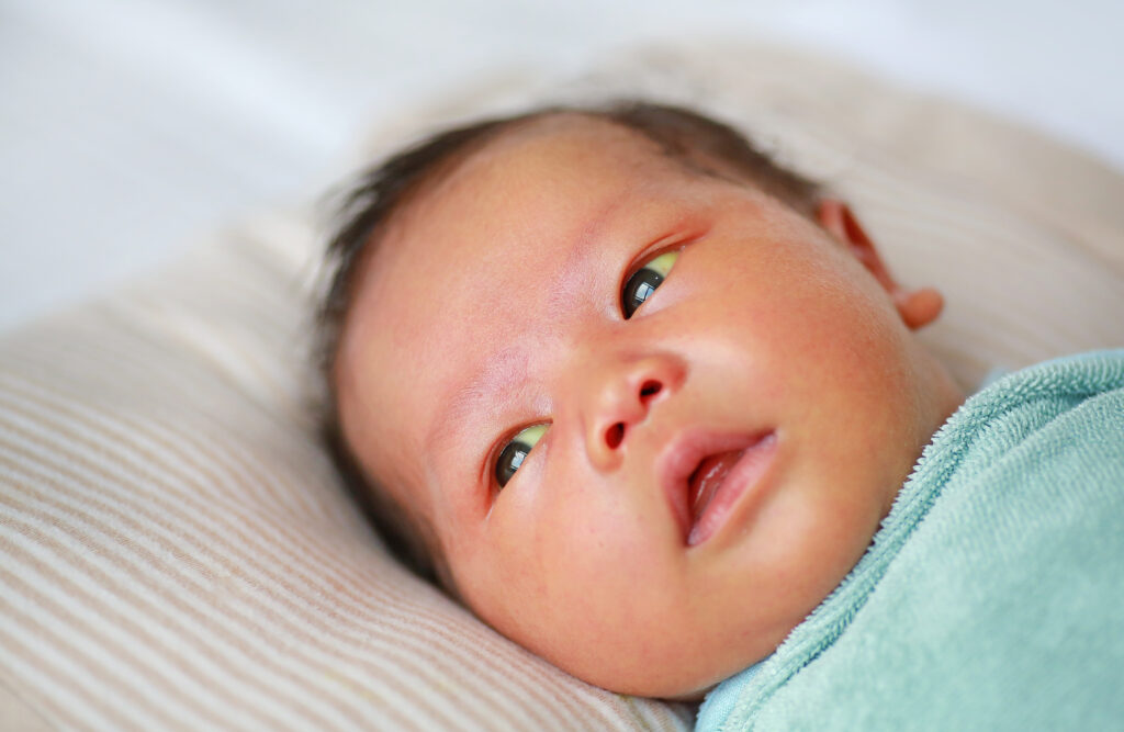 Newborn with jaundice